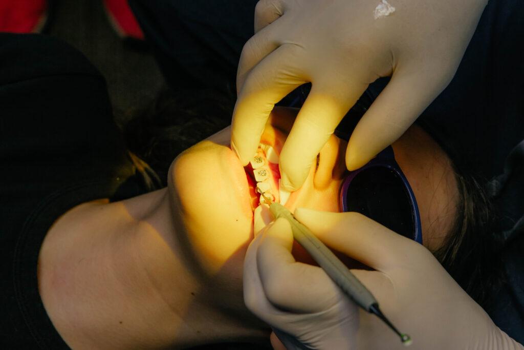 Orthodontist adjusting metal braces on a patient’s teeth during treatment